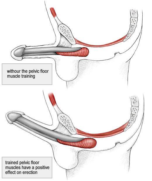 kegel exercises training